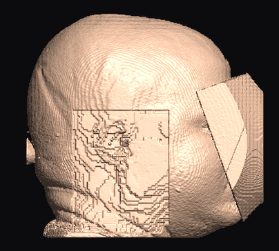 side view after face+ears with ear_mode cut