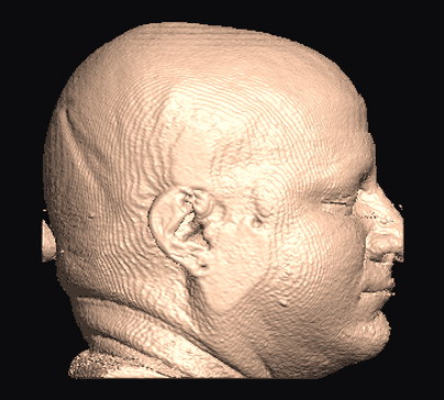 side view of the input, pinna intact