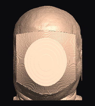 adaptive result on the MRHead sample