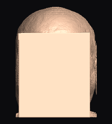 block result