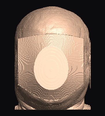 blur result on the MRHead sample