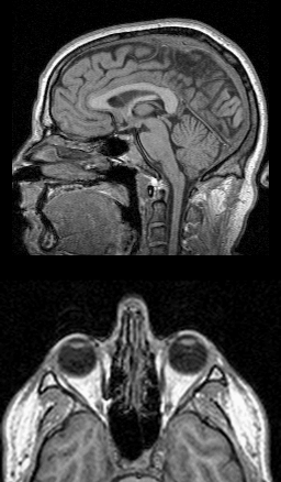 input: sagittal and axial slices